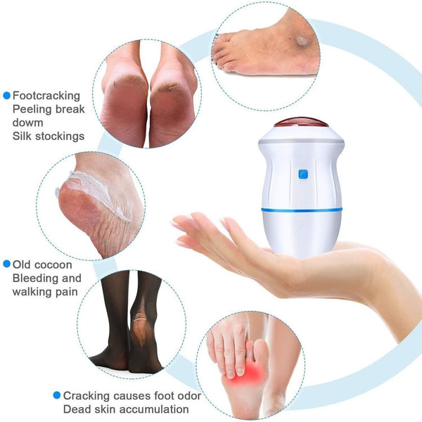 Electric Foot  Callus Remover Foot Pedicure Tools Rechargeable.
